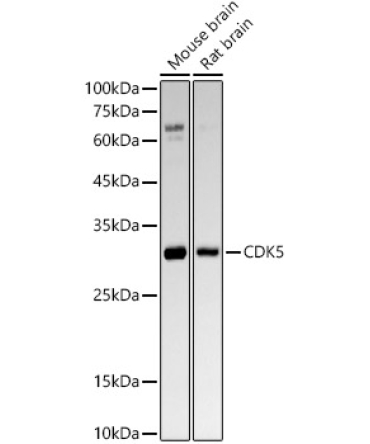 CDK5 Rabbit Monoclonal Antibody [KO Validated]