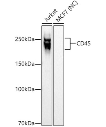 CD45 Rabbit Monoclonal Antibody