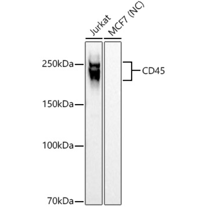 CD45 Rabbit Monoclonal Antibody