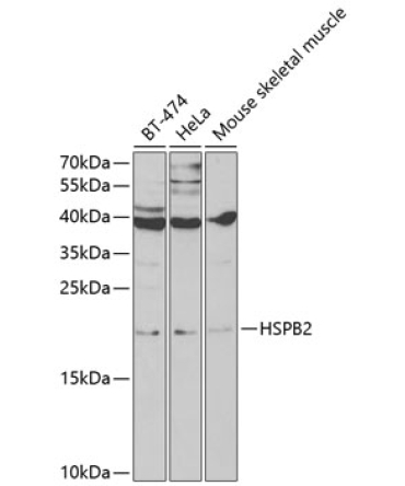 HSPB2 Rabbit Polyclonal Antibody