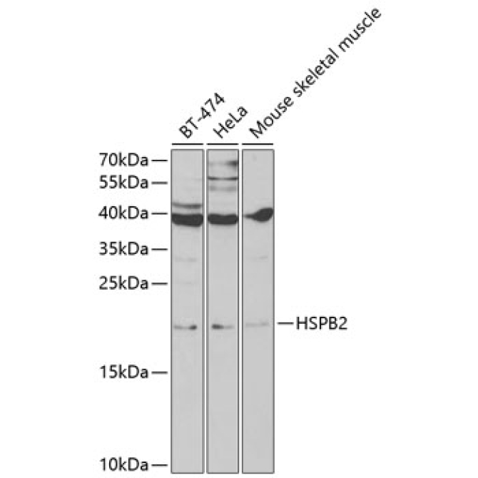 HSPB2 Rabbit Polyclonal Antibody