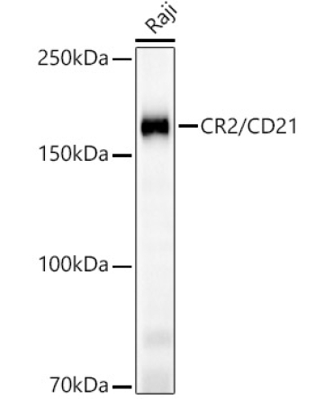 CR2/CD21 Rabbit Monoclonal Antibody