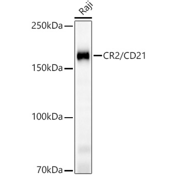 CR2/CD21 Rabbit Monoclonal Antibody