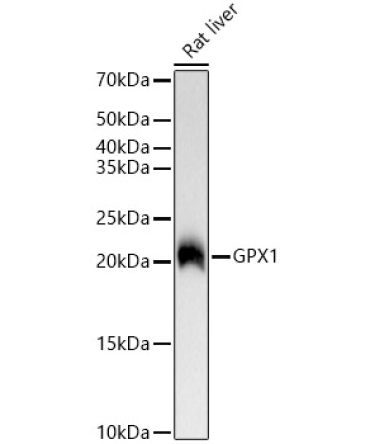 GPX1 Rabbit Monoclonal Antibody