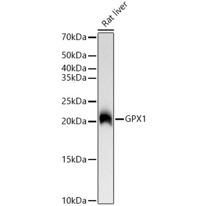 GPX1 Rabbit Monoclonal Antibody