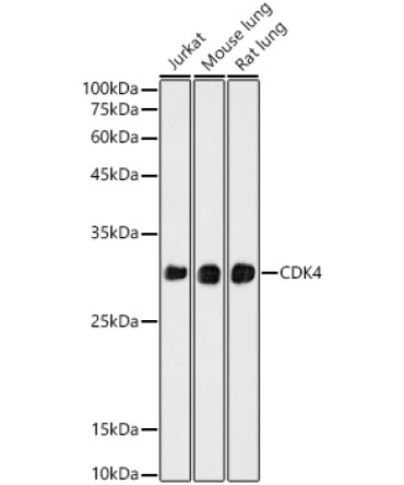 CDK4 Rabbit Monoclonal Antibody