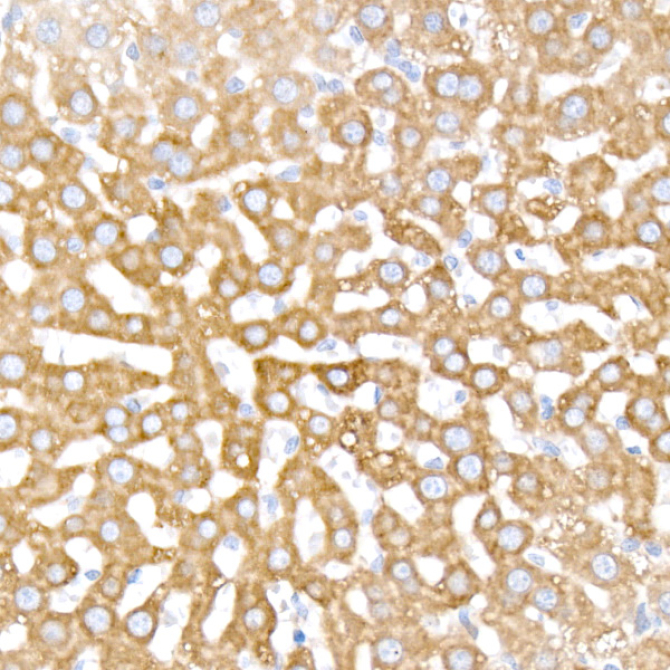 INSIG1 Rabbit Monoclonal Antibody