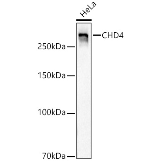 CHD4 Rabbit Monoclonal Antibody