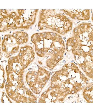 METTL4 Rabbit Monoclonal Antibody