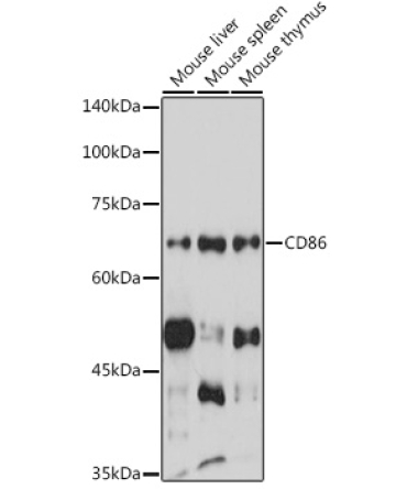 CD86 Rabbit Polyclonal Antibody