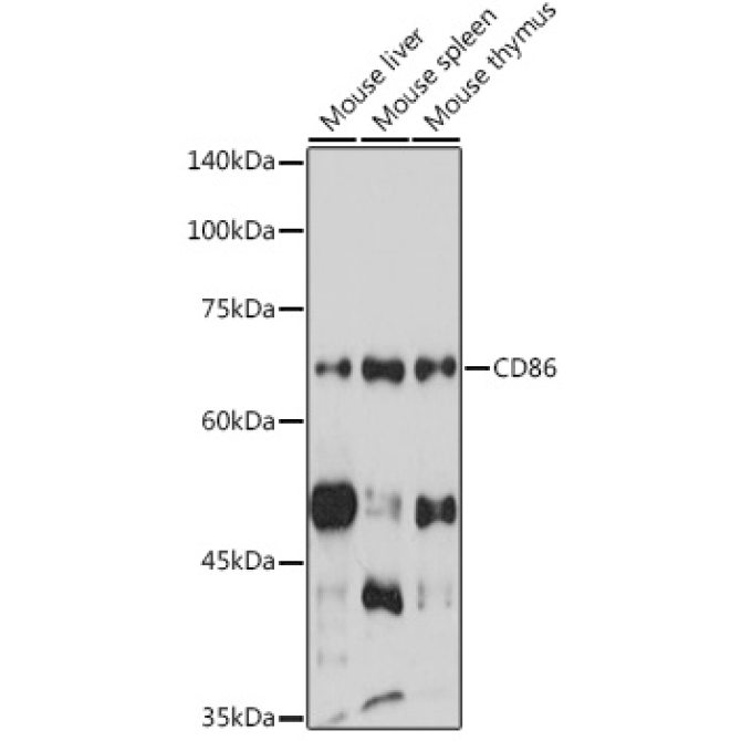 CD86 Rabbit Polyclonal Antibody
