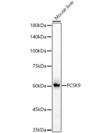 PCSK9 Rabbit Polyclonal Antibody