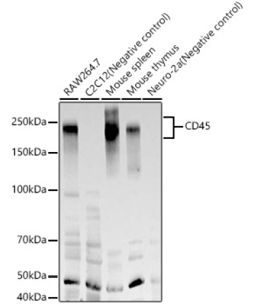 CD45 Rabbit Monoclonal Antibody