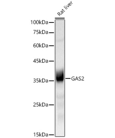 GAS2 Rabbit Monoclonal Antibody