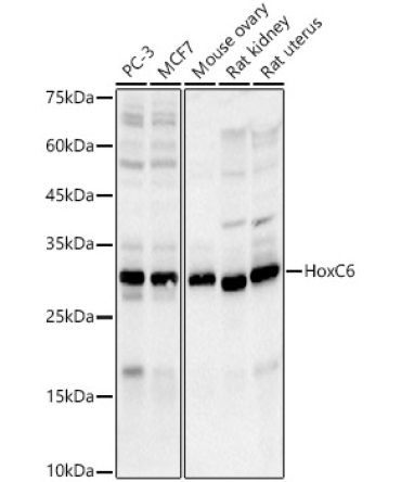 HoxC6 Rabbit Monoclonal Antibody