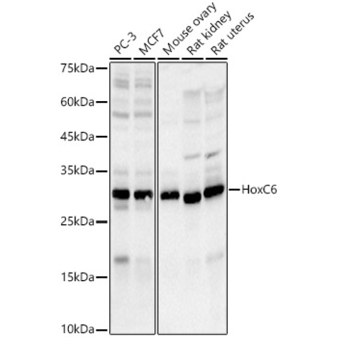 HoxC6 Rabbit Monoclonal Antibody
