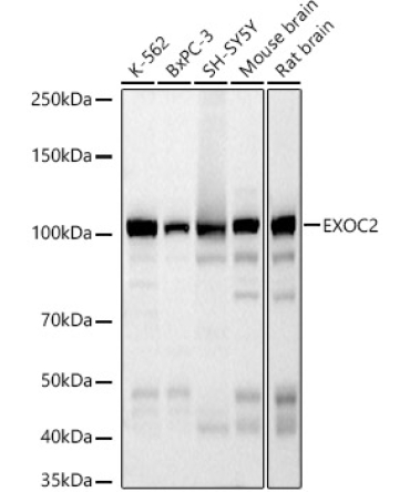 EXOC2 Rabbit Monoclonal Antibody