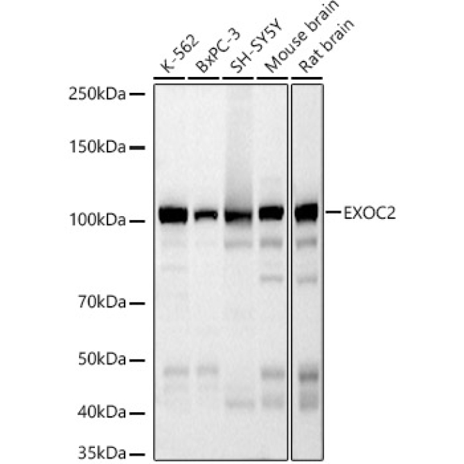 EXOC2 Rabbit Monoclonal Antibody