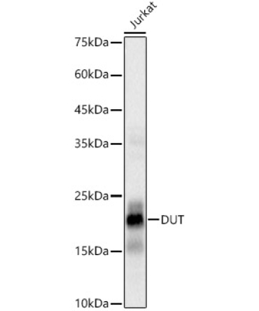 DUT Rabbit Monoclonal Antibody