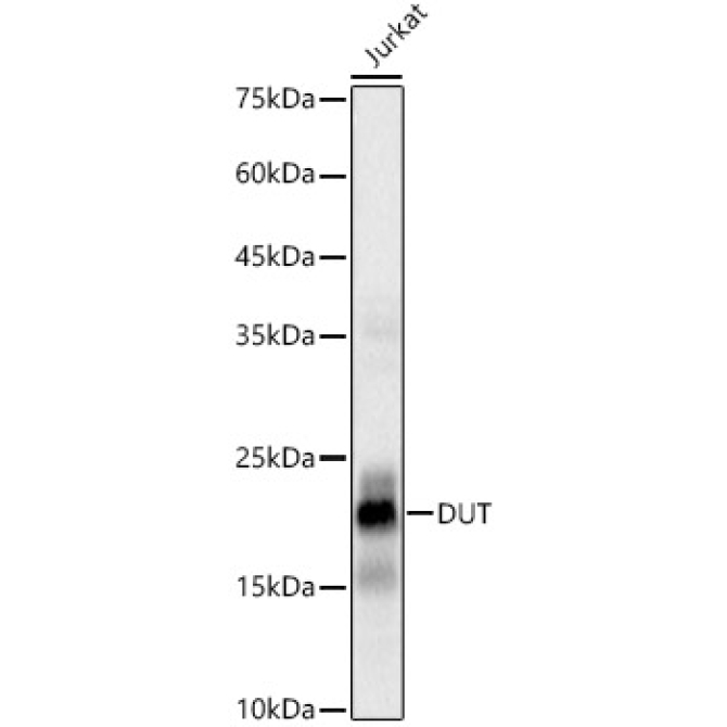 DUT Rabbit Monoclonal Antibody