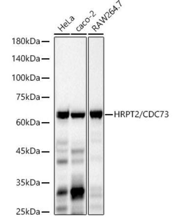 HRPT2 / CDC73 Rabbit Monoclonal Antibody