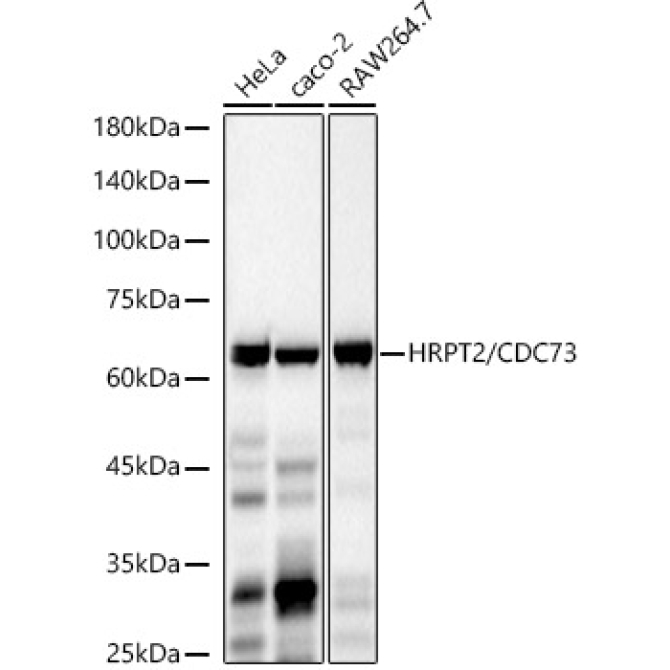 HRPT2 / CDC73 Rabbit Monoclonal Antibody