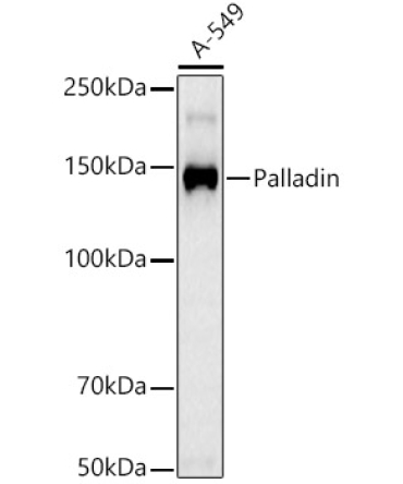 Palladin Rabbit Monoclonal Antibody