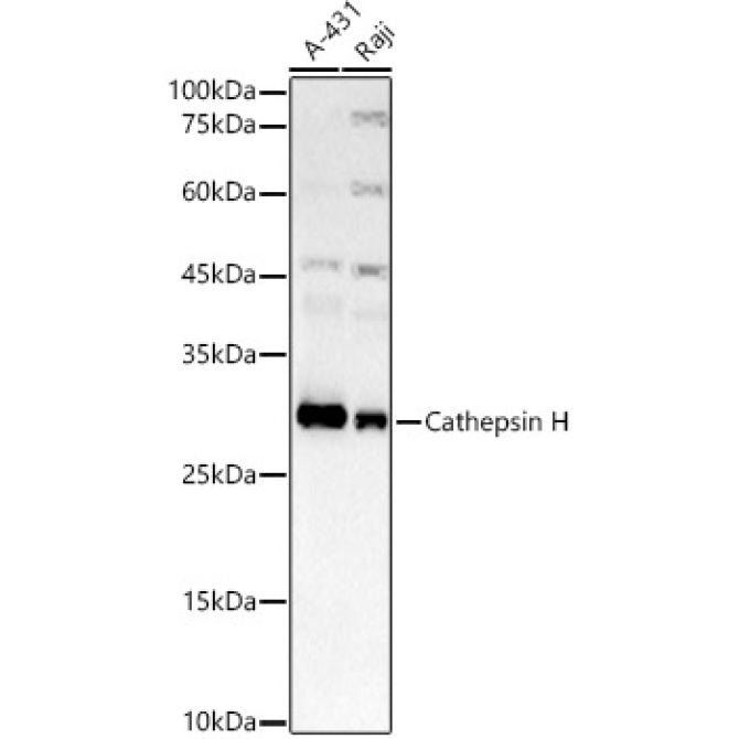 Cathepsin H Rabbit Monoclonal Antibody