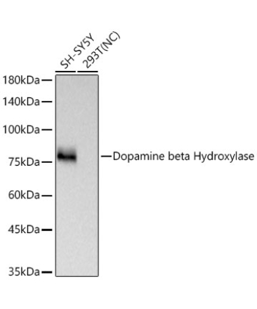 Dopamine beta Hydroxylase Rabbit Monoclonal Antibody
