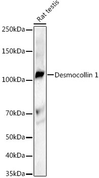 Desmocollin 1 Rabbit Monoclonal Antibody