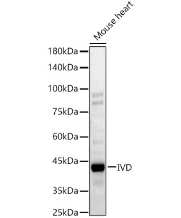 IVD Rabbit Polyclonal Antibody