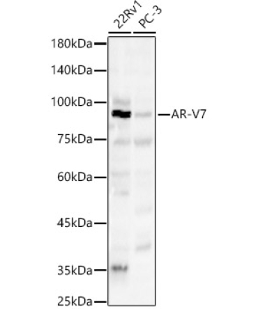 AR-V7 Rabbit Polyclonal Antibody