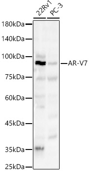 AR-V7 Rabbit Polyclonal Antibody