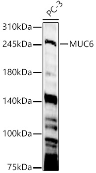 MUC6 Rabbit Polyclonal Antibody