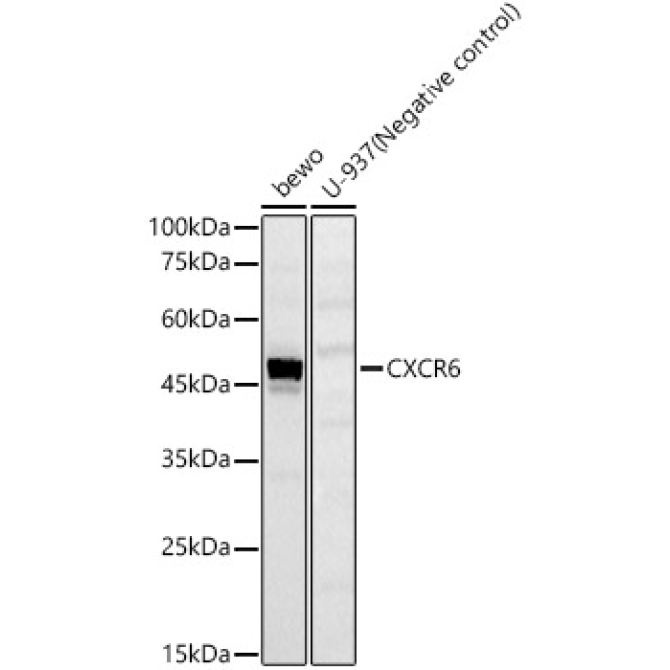 CXCR6 Rabbit Polyclonal Antibody