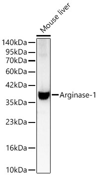 Arginase-1 Rabbit Polyclonal Antibody