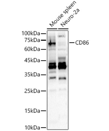 CD86 Rabbit Polyclonal Antibody