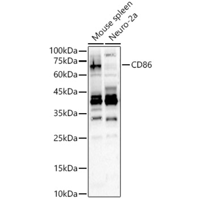 CD86 Rabbit Polyclonal Antibody