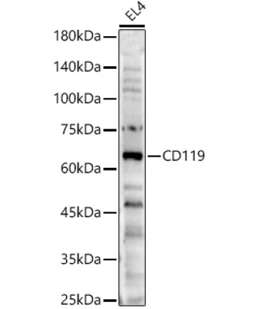 CD119 Rabbit Polyclonal Antibody