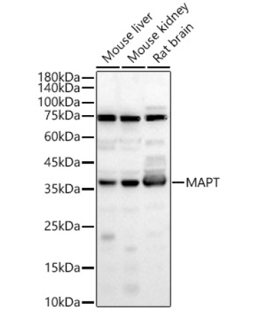 MAPT Rabbit Polyclonal Antibody
