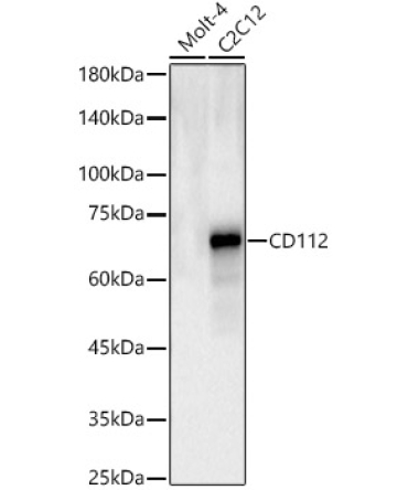 CD112 Rabbit Polyclonal Antibody