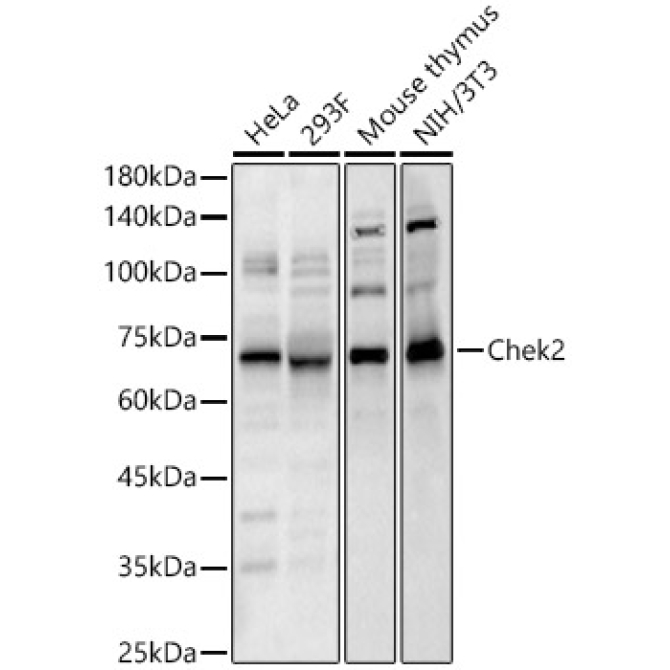 Chek2 Rabbit Polyclonal Antibody
