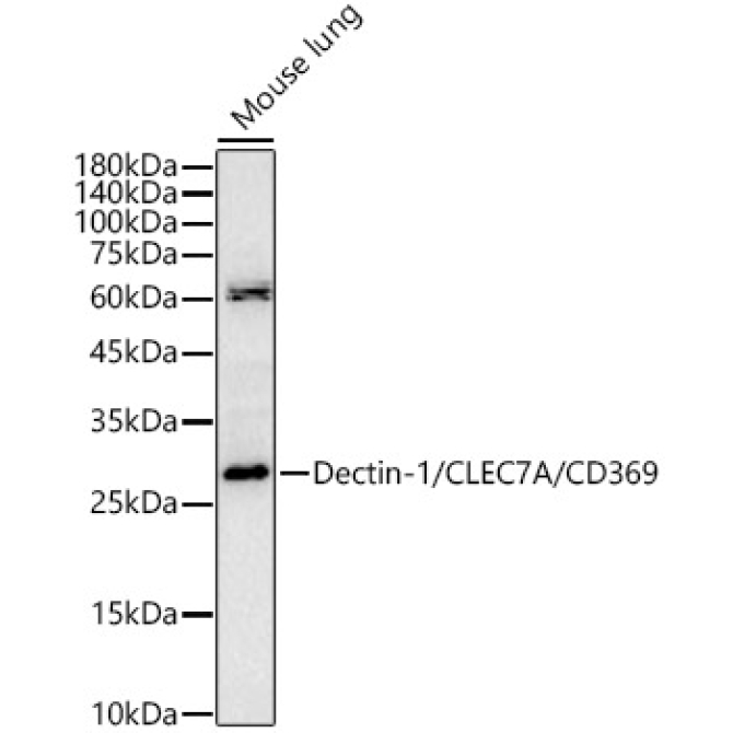 Dectin-1/CLEC7A/CD369 Rabbit Polyclonal Antibody