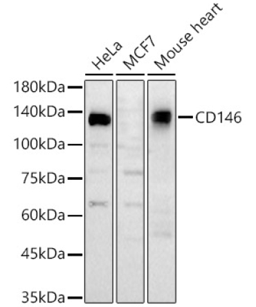 CD146 Rabbit Polyclonal Antibody