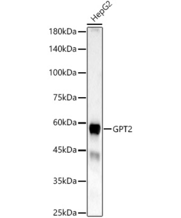 GPT2 Rabbit Polyclonal Antibody