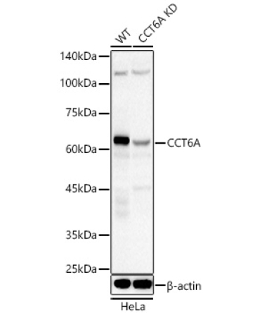 CCT6A Rabbit Polyclonal Antibody