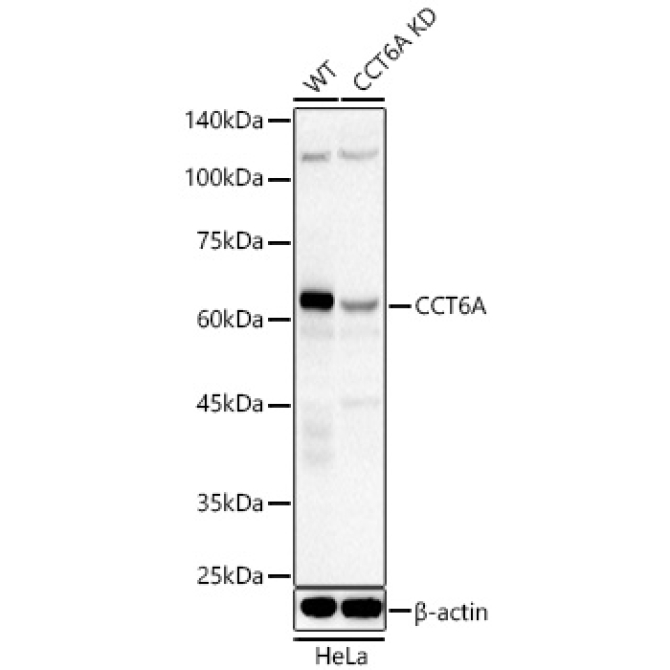 CCT6A Rabbit Polyclonal Antibody