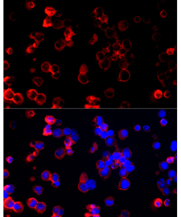 CLIC1 Rabbit Polyclonal Antibody [KD Validated]