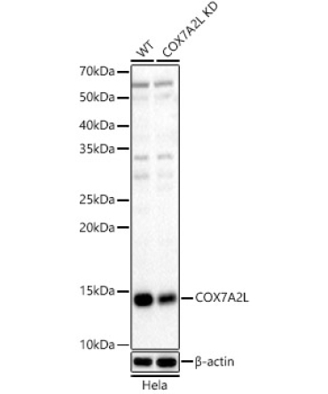 COX7A2L Rabbit Polyclonal Antibody [KD Validated]