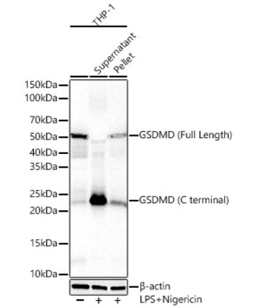 Gasdermin D (Full Length+C terminal) Rabbit Monoclonal Antibody